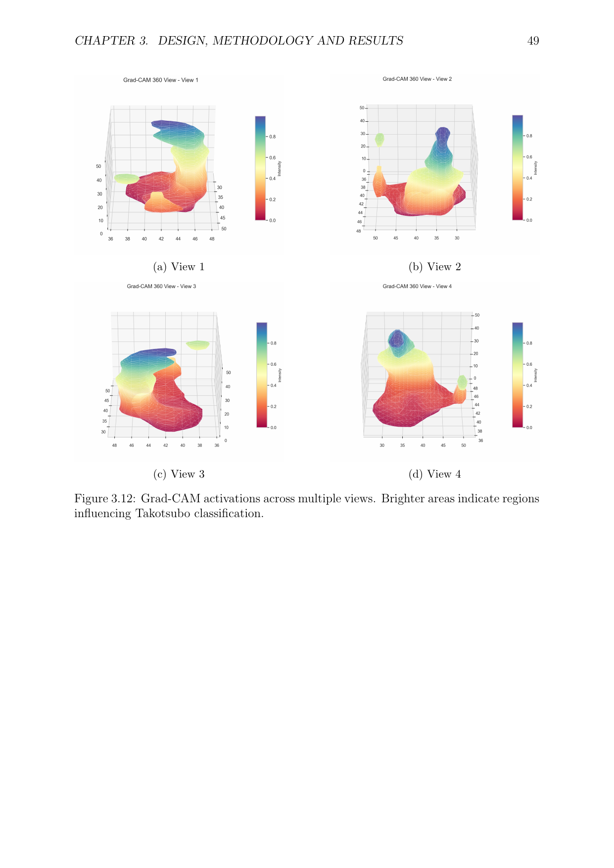Grad-CAM activations across 4 views of the heart volume